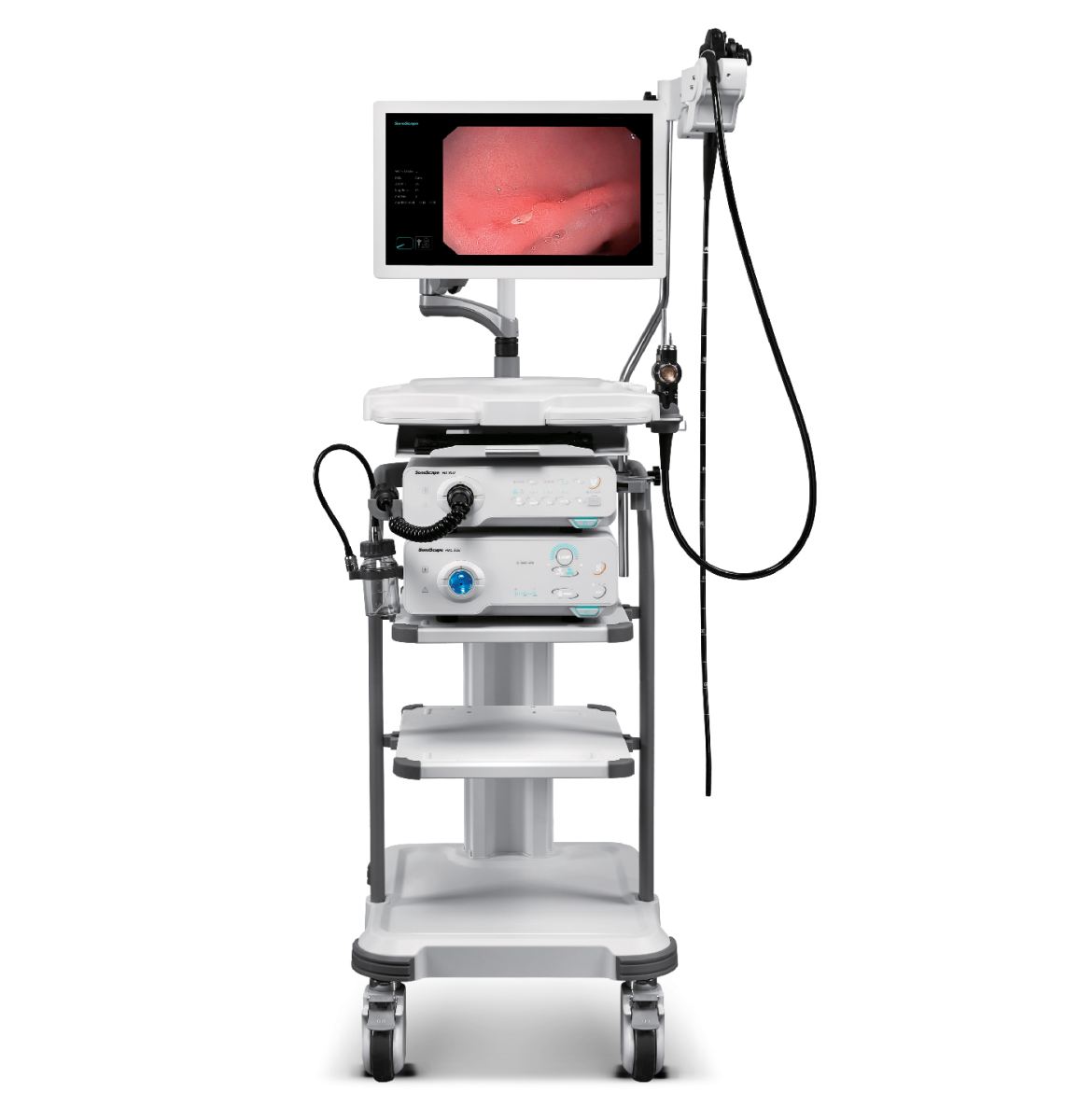 Thiết bị Nội Soi Tiêu Hóa SonoScape